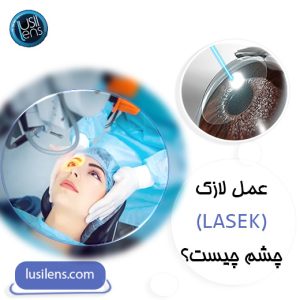 عمل لازک
