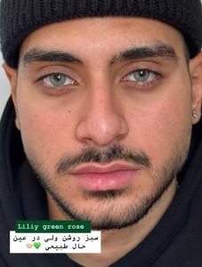 لنز سبز عسلی