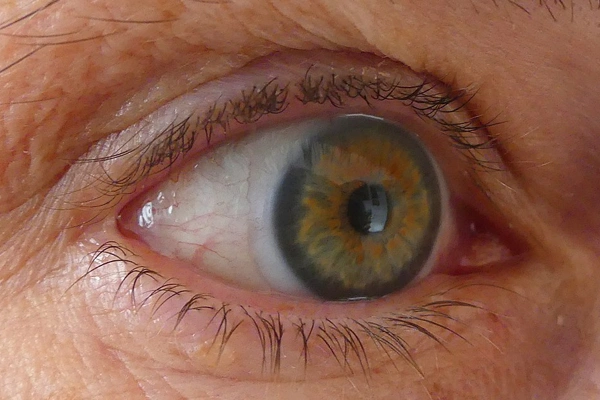 لنز چشم چیست